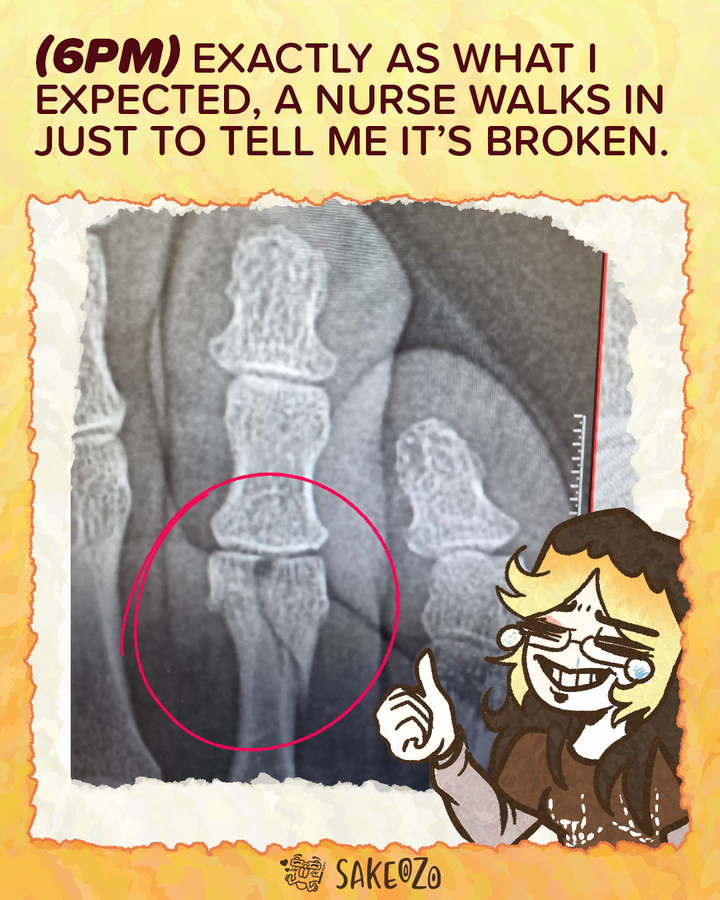 Hourly Comics Day panel captioned "(6PM) EXACTLY AS WHAT I EXPECTED, A NURSE WALKS IN JUST TO TELL ME IT'S BROKEN." showing a finger X-ray with a red circle on the fracture and a cartoon self-portrait giving a thumbs up.
